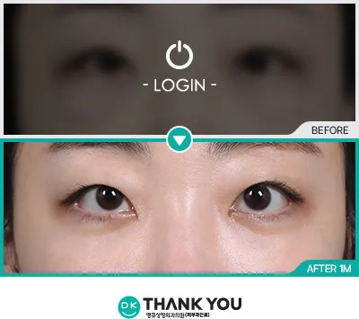 Before/After