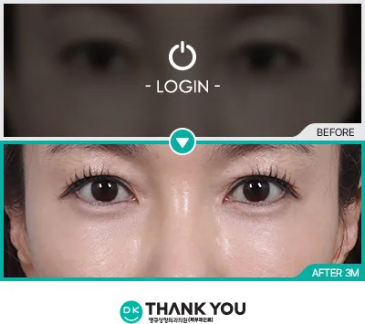 Before/After