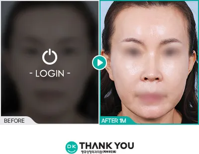Before/After