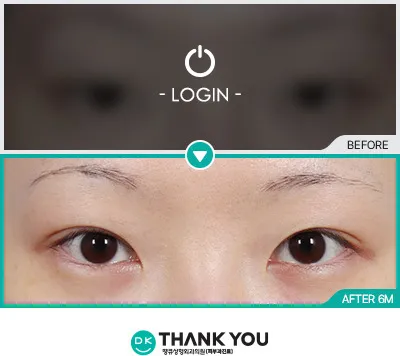 Before/After