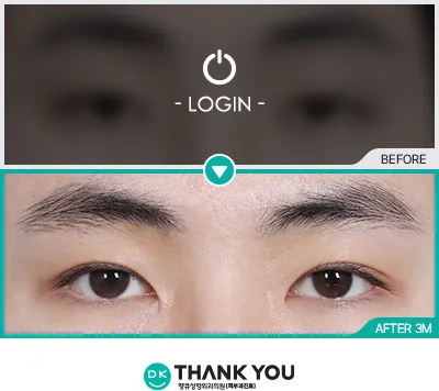 Before/After