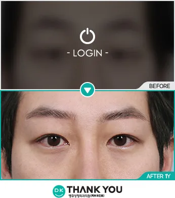 Before/After