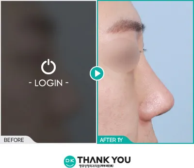 Before/After