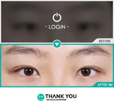 Before/After