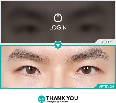 Before/After