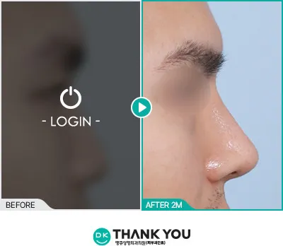 Before/After