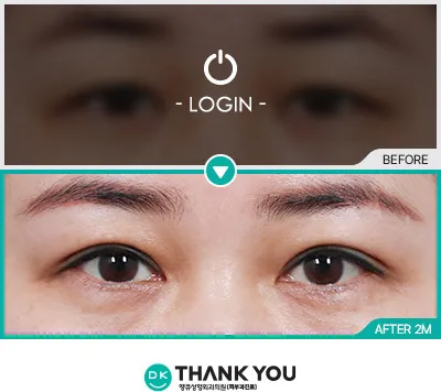 Before/After
