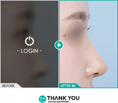 Before/After