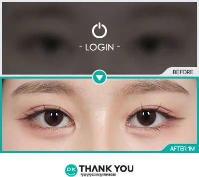 Before/After