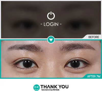 Before/After