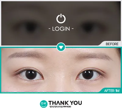 Before/After