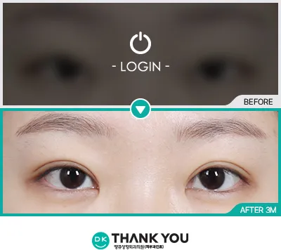 Before/After