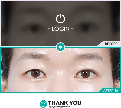 Before/After