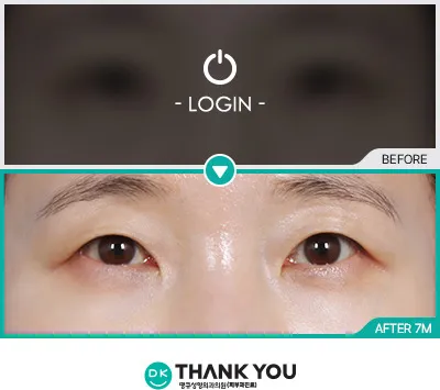 Before/After