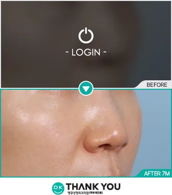 Before/After