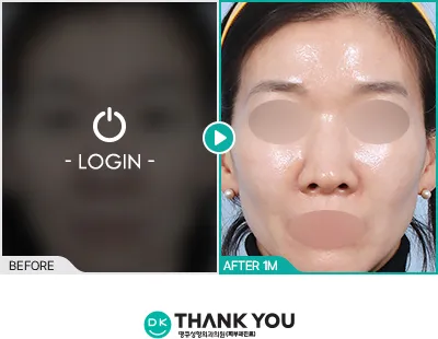 Before/After