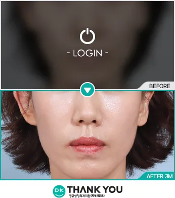 Before/After