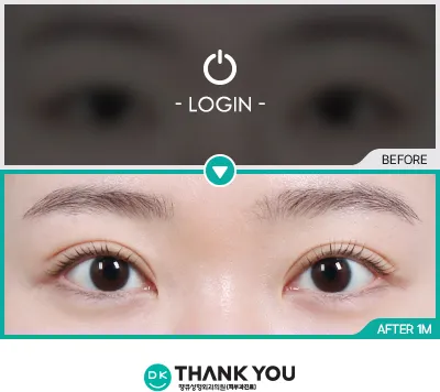 Before/After
