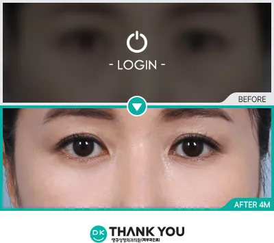 Before/After