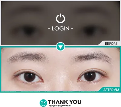 Before/After