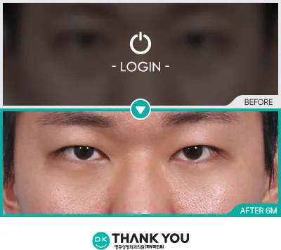 Before/After