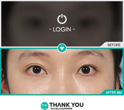 Before/After