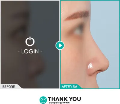 Before/After