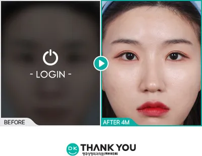 Before/After