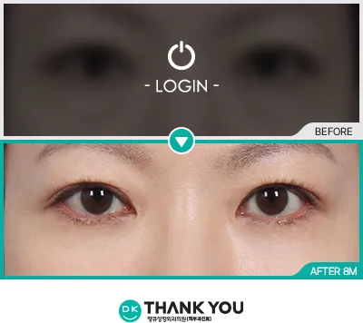 Before/After