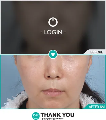 Before & After