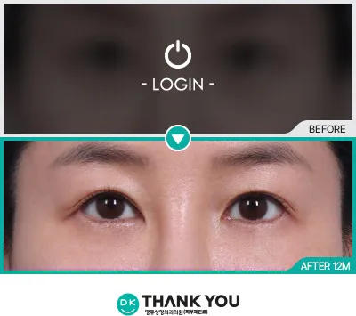 Before/After