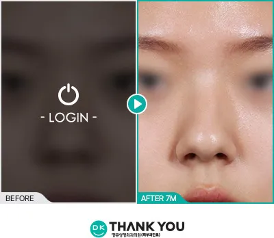 Before/After