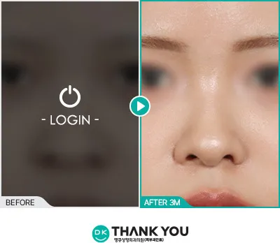 Before/After
