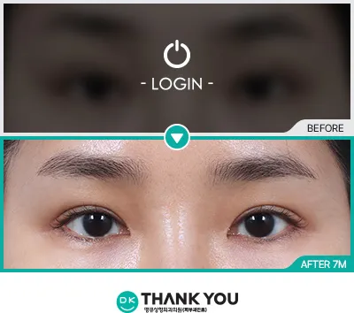 Before/After