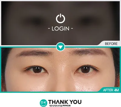 Before/After