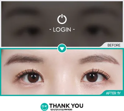 Before/After