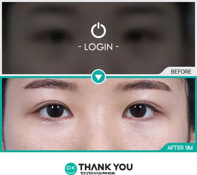 Before/After