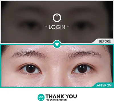 Before/After