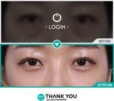 Before/After