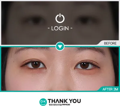 Before/After