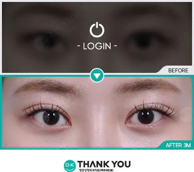 Before/After