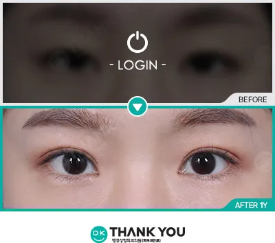 Before/After