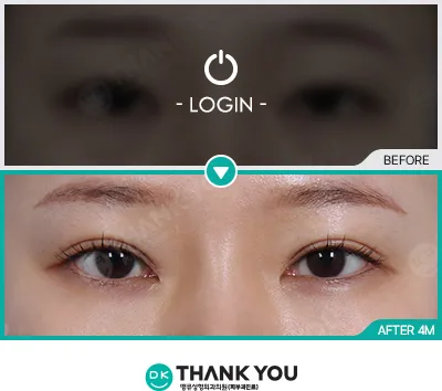 Before/After