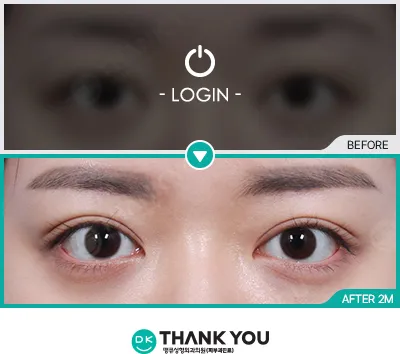 Before/After