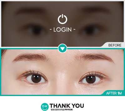 Before/After