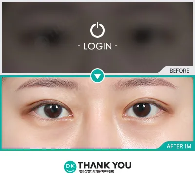 Before/After