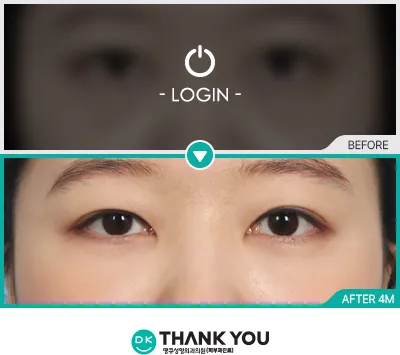 Before/After