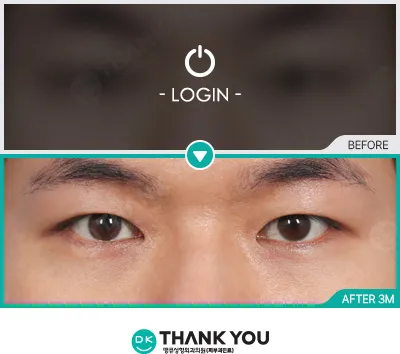 Before & After