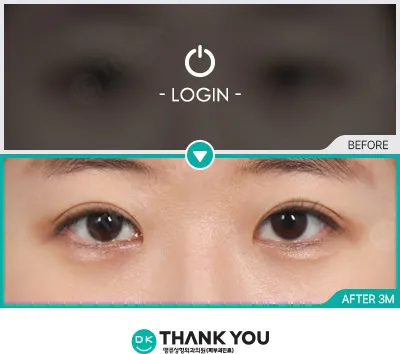 Before/After