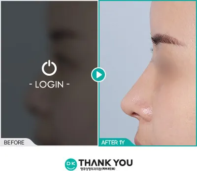 Before/After